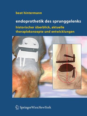 cover image of Endoprothetik des Sprunggelenks